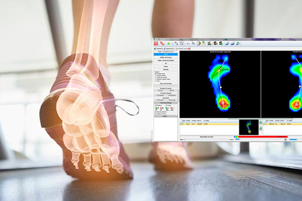 Baropodometria Computadorizada Baropodometria Computadorizada